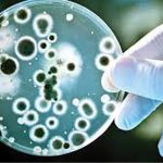 گلوتارآلدهید Glutaraldehyde2