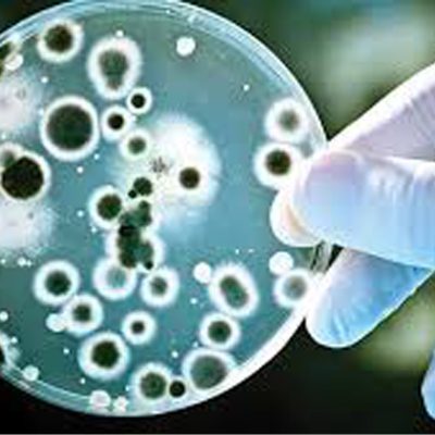 گلوتارآلدهید Glutaraldehyde2